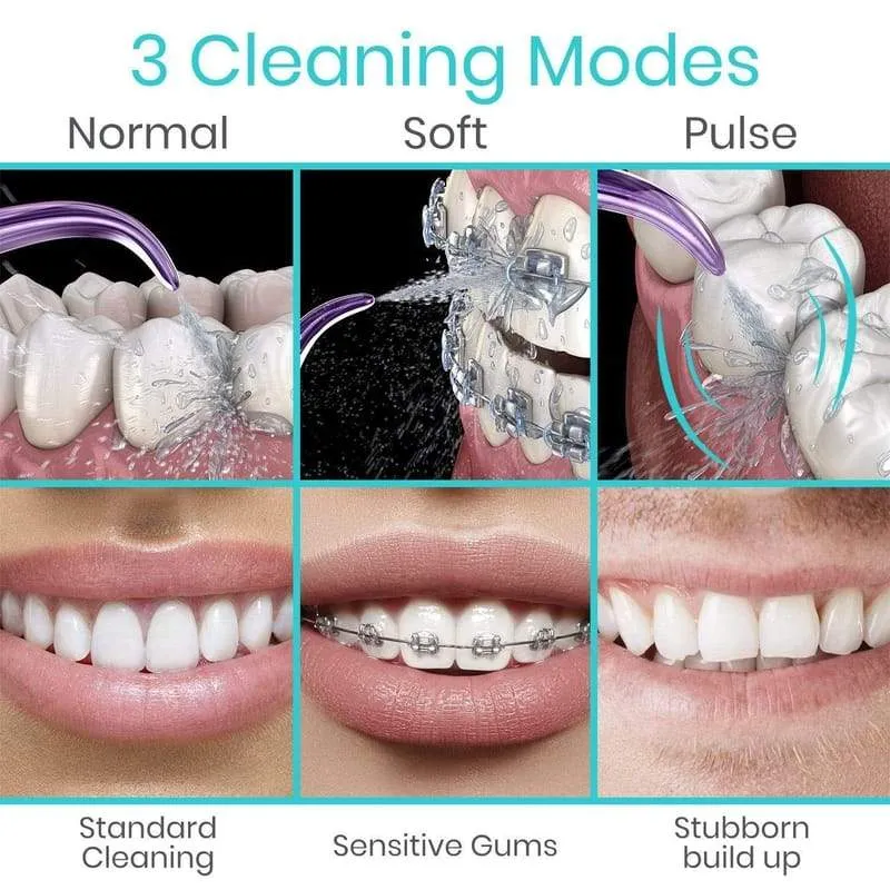 Vive Dental Water Flosser